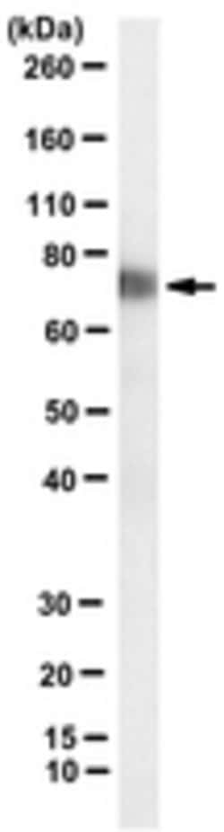 Myosin 7 (MYH7) Mouse anti-Human, Mouse, Clone: BA-D5, MilliporeSigma 100